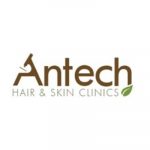 Antech Hair Clinic